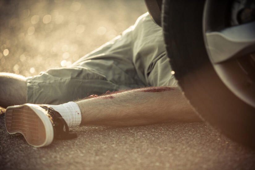 Photo of an Injured Man