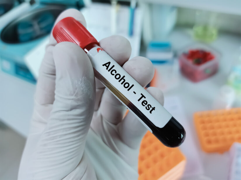 Blood sample Blood sample for alcohol test